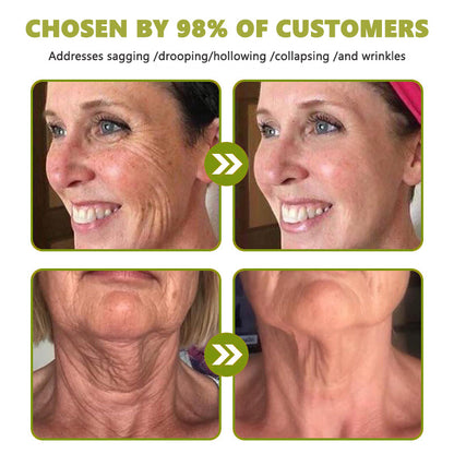 Made and shipped from the USA👩‍⚕️---Awzlove® Luxurious Retinol &  Matrixyl 3000 Firming Wrinkle Removal Cream💯-Last Day Promotion 70% OFF💯