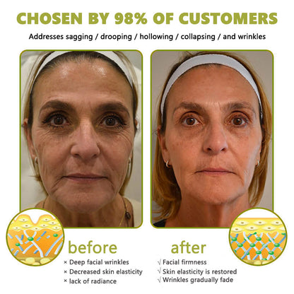 Made and shipped from the USA👩‍⚕️---Awzlove® Luxurious Retinol &  Matrixyl 3000 Firming Wrinkle Removal Cream💯-Last Day Promotion 70% OFF💯