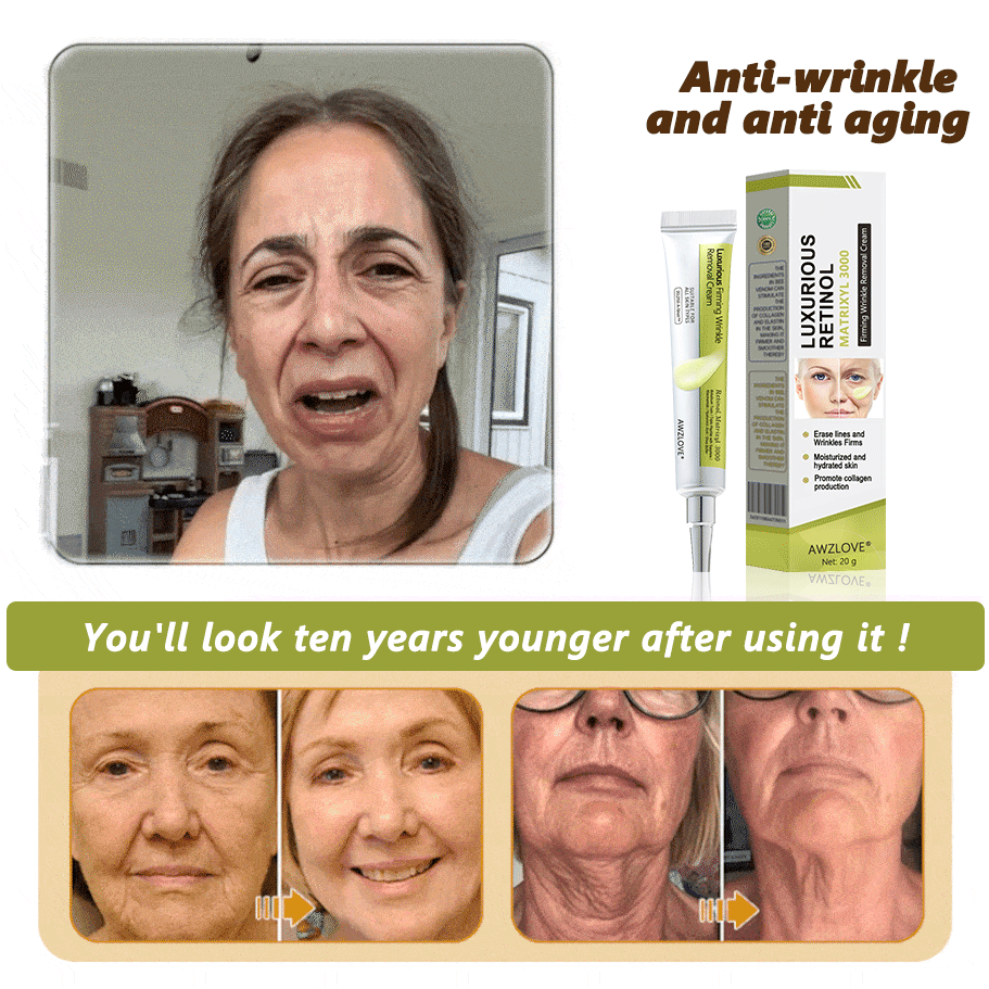 Made and shipped from the USA👩‍⚕️---Awzlove® Luxurious Retinol &  Matrixyl 3000 Firming Wrinkle Removal Cream💯-Last Day Promotion 70% OFF💯