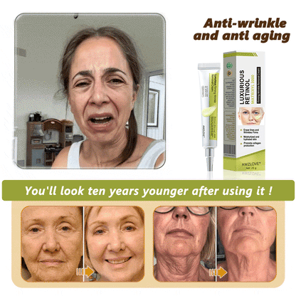 Made and shipped from the USA👩‍⚕️---Awzlove® Luxurious Retinol &  Matrixyl 3000 Firming Wrinkle Removal Cream💯-Last Day Promotion 70% OFF💯
