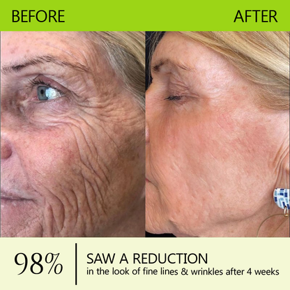 👩‍⚕️Made and shipped from USA 🏆Healrize® Botox & Vita-A Retinol Shot Wrinkle-Lift Tightening cream - Last Day Promotion 70% OFF🏆