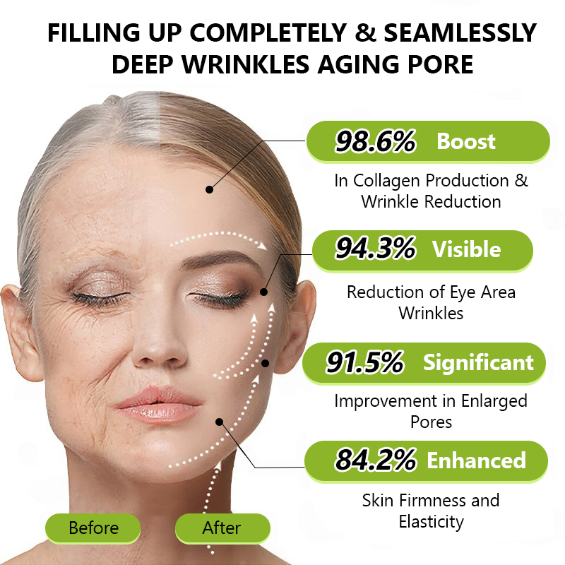 👩‍⚕️Made and shipped from USA 🏆Healrize® Botox & Vita-A Retinol Shot Wrinkle-Lift Tightening cream - Last Day Promotion 70% OFF🏆