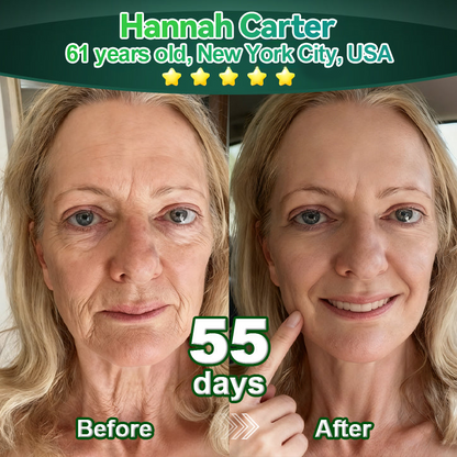 Officially Authorised Exclusive Edition|CareRegen® Stem Cell & Collagen Peptide Renewal Drops (Lift & Firm Sagging Skin & Reduce Wrinkle Formation)👍