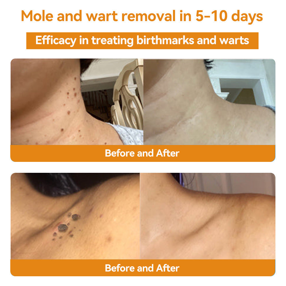 𝑇𝑢𝑟𝑜𝑛𝑢™ Bee Venom Skin Treatment Cream（𝐴𝐴𝐷 𝑅𝑒𝑐𝑜𝑚𝑚𝑒𝑛𝑑𝑒𝑑）🏵️