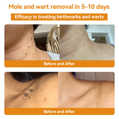 𝑇𝑢𝑟𝑜𝑛𝑢™ Bee Venom Skin Treatment Cream（𝐴𝐴𝐷 𝑅𝑒𝑐𝑜𝑚𝑚𝑒𝑛𝑑𝑒𝑑）🏵️