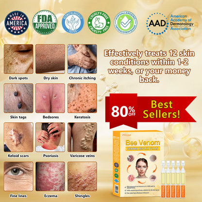 【𝐋𝐚𝐬𝐭 𝐃𝐚𝐲 𝐏𝐫𝐨𝐦𝐨𝐭𝐢𝐨𝐧 𝟔𝟎% 𝐎𝐅𝐅】🏪𝐀𝐰𝐳𝐥𝐨𝐯𝐞® 𝐁𝐞𝐞 𝐕𝐞𝐧𝐨𝐦 𝐒𝐞𝐫𝐮𝐦 𝐑𝐞𝐩𝐚𝐢𝐫 𝐕𝐢𝐚𝐥𝐬 👨‍⚕️(𝟐𝟒/𝟕 𝐑𝐞𝐩𝐚𝐢𝐫 | 𝐒𝐨𝐨𝐭𝐡𝐢𝐧𝐠 𝐑𝐞𝐥𝐢𝐞𝐟 | 𝟗𝟎% 𝐋𝐞𝐬𝐬 𝐈𝐧𝐟𝐥𝐚𝐦𝐦𝐚𝐭𝐢𝐨𝐧)🌊