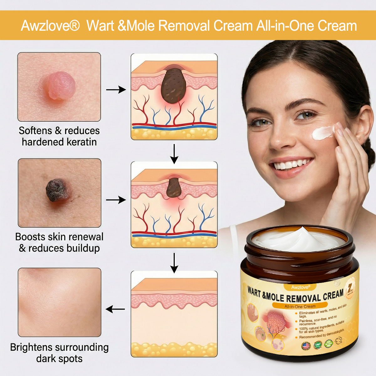 👩‍⚕️Made and Shipped from USA ✅Awzlove® Wart &Mole Removal All-in-One Cream🏆
