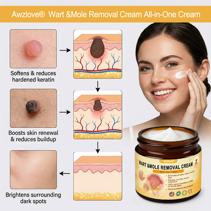👩‍⚕️Made and Shipped from USA ✅Awzlove® Wart &Mole Removal All-in-One Cream🏆