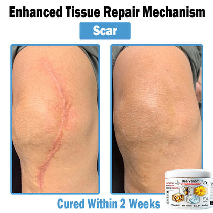 TODAHOF™ Bee Venom Multi-Symptom Skin Treatment Cream (NPF RECOMMENDS)💎