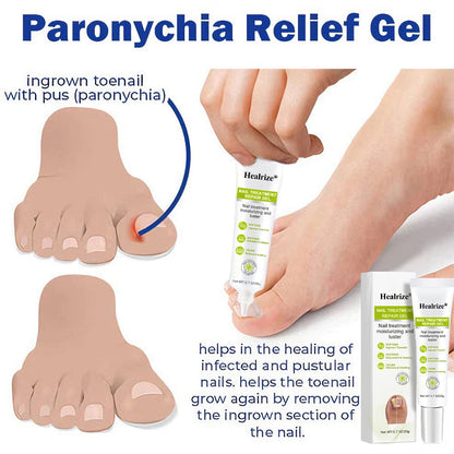 Healrize® NAIL TREATMENT REPAIR GEL(Removal Paronychia,Fungal infections, ingrown nail, discolored or damaged nails)💅