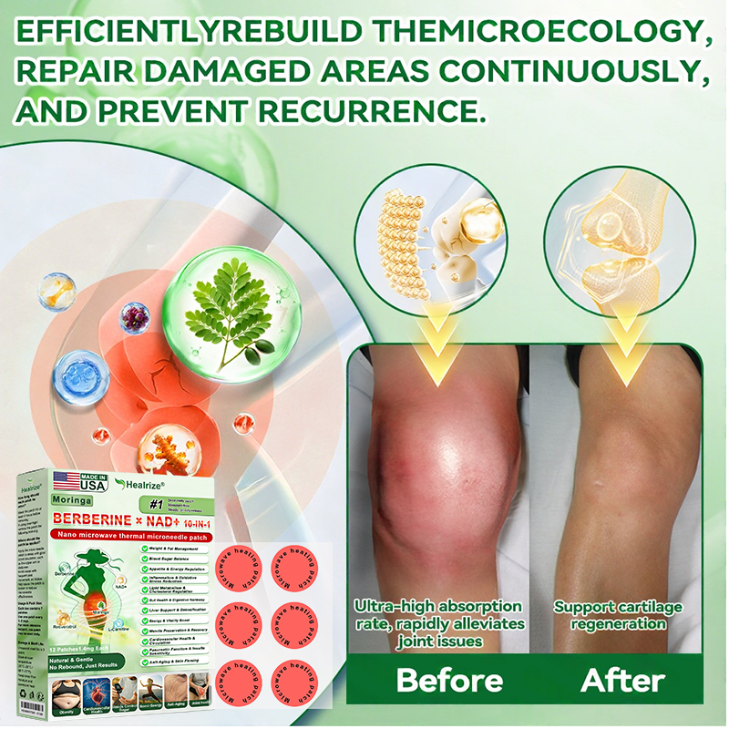 𝑶𝒇𝒇𝒊𝒄𝒊𝒂𝒍 𝑺𝒕𝒐𝒓𝒆  | 👨‍⚕️Healrize®𝑴𝒐𝒓𝒊𝒏𝒈𝗮 · 𝗕𝗲𝗿𝗯𝗲𝗿𝙞𝙣𝙚 × 𝙉𝘼𝐃+ 𝟏𝟎-𝐢𝐧-𝟏 𝗔𝗱𝘃𝗮𝗻𝗰𝙚𝙙 Nano Microwave Thermal Metabolic Patch(𝐉𝐮𝐬𝐭 𝐨𝐧𝐜𝐞 𝐚 𝐝𝐚𝐲, 𝐯𝐢𝐬𝐢𝐛𝐥𝐞 𝐜𝐡𝐚𝐧𝐠𝐞𝐬 𝐢𝐧 𝟕 𝐝𝐚𝐲𝐬） ✅ 𝐅𝐨𝐫 𝐨𝐛𝐞𝐬𝐢𝐭𝐲, 🅛🅞🅞🅢🅔 🅢🅚🅘🅝,𝐝𝐢𝐚𝐛𝐞𝐭𝐞𝐬, 𝐬𝐥𝐞𝐞𝐩 𝐚𝐩𝐧𝐞𝐚, 𝐣𝐨𝐢𝐧𝐭 𝐢𝐬𝐬𝐮𝐞𝐬, 𝐚𝐧𝐝 𝐦𝐨𝐫𝐞 👑