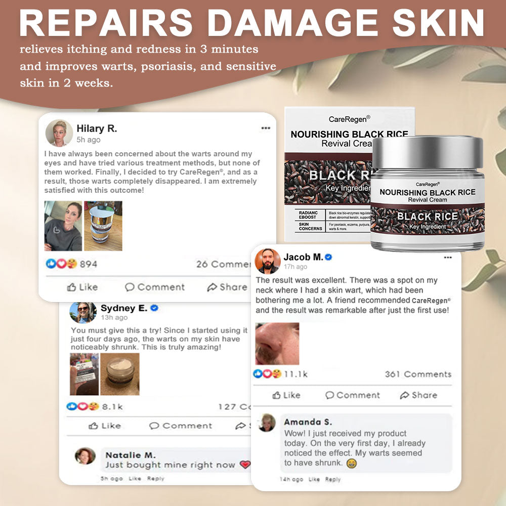 𝐂𝐚𝐫𝐞𝐑𝐞𝐠𝐞𝐧® N𝐨u𝐫i𝐬h𝐢n𝐠 𝐁l𝐚c𝐤 𝐑i𝐜e R𝐞v𝐢v𝐚l C𝐫e𝐚m 💫 | 𝐄f𝐟e𝐜t𝐢v𝐞 𝐨n p𝐬o𝐫i𝐚s𝐢s, 𝐞c𝐳e𝐦a, 𝐩u𝐫p𝐮r𝐚, s𝐮n𝐬p𝐨t𝐬, t𝐚g𝐬, w𝐚r𝐭s & b𝐞y𝐨n𝐝