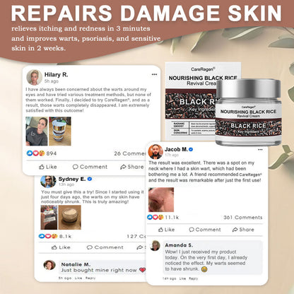 𝐂𝐚𝐫𝐞𝐑𝐞𝐠𝐞𝐧® N𝐨u𝐫i𝐬h𝐢n𝐠 𝐁l𝐚c𝐤 𝐑i𝐜e R𝐞v𝐢v𝐚l C𝐫e𝐚m 💫 | 𝐄f𝐟e𝐜t𝐢v𝐞 𝐨n p𝐬o𝐫i𝐚s𝐢s, 𝐞c𝐳e𝐦a, 𝐩u𝐫p𝐮r𝐚, s𝐮n𝐬p𝐨t𝐬, t𝐚g𝐬, w𝐚r𝐭s & b𝐞y𝐨n𝐝