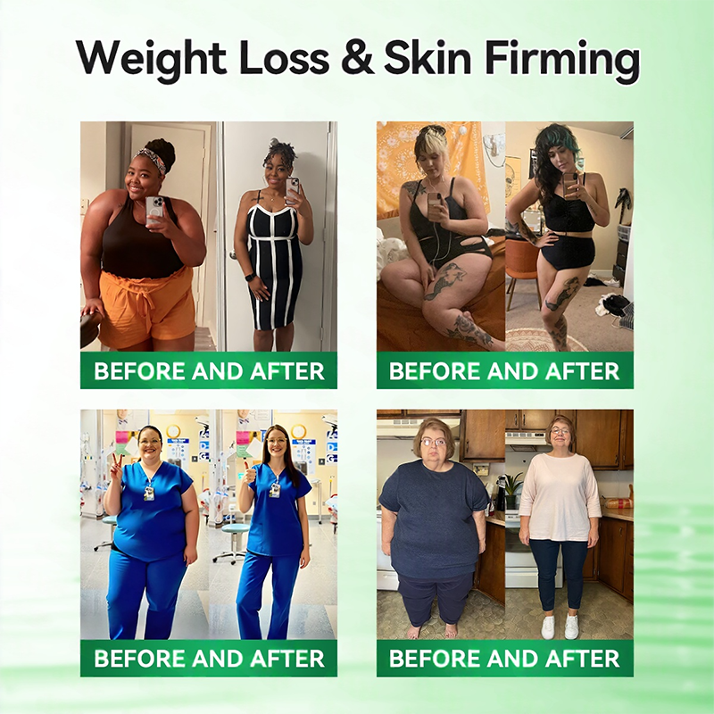 𝑶𝒇𝒇𝒊𝒄𝒊𝒂𝒍 𝑺𝒕𝒐𝒓𝒆  | 👨‍⚕️Healrize®𝑴𝒐𝒓𝒊𝒏𝒈𝗮 · 𝗕𝗲𝗿𝗯𝗲𝗿𝙞𝙣𝙚 × 𝙉𝘼𝐃+ 𝟏𝟎-𝐢𝐧-𝟏 𝗔𝗱𝘃𝗮𝗻𝗰𝙚𝙙 Nano Microwave Thermal Metabolic Patch(𝐉𝐮𝐬𝐭 𝐨𝐧𝐜𝐞 𝐚 𝐝𝐚𝐲, 𝐯𝐢𝐬𝐢𝐛𝐥𝐞 𝐜𝐡𝐚𝐧𝐠𝐞𝐬 𝐢𝐧 𝟕 𝐝𝐚𝐲𝐬） ✅ 𝐅𝐨𝐫 𝐨𝐛𝐞𝐬𝐢𝐭𝐲, 🅛🅞🅞🅢🅔 🅢🅚🅘🅝,𝐝𝐢𝐚𝐛𝐞𝐭𝐞𝐬, 𝐬𝐥𝐞𝐞𝐩 𝐚𝐩𝐧𝐞𝐚, 𝐣𝐨𝐢𝐧𝐭 𝐢𝐬𝐬𝐮𝐞𝐬, 𝐚𝐧𝐝 𝐦𝐨𝐫𝐞 👑