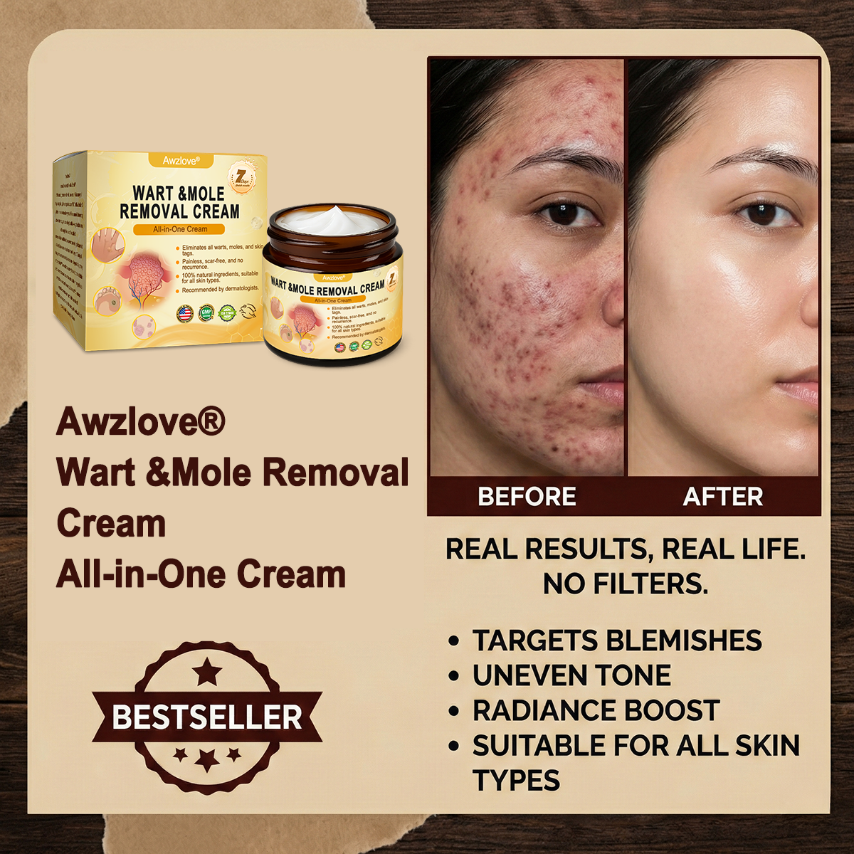 👩‍⚕️Made and Shipped from USA ✅Awzlove® Wart &Mole Removal All-in-One Cream🏆