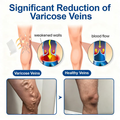🇺🇸👨‍⚕️👍✅Healrize® VeinTarget Microneedle Patch🚀Instant Relief, Long-Term Results 🚀