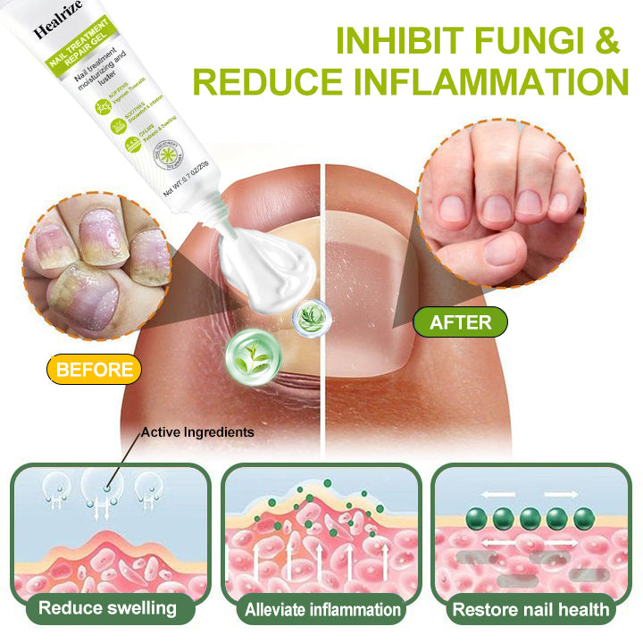 Healrize® NAIL TREATMENT REPAIR GEL(Removal Paronychia,Fungal infections, ingrown nail, discolored or damaged nails)💅