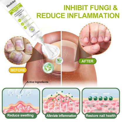 Healrize® NAIL TREATMENT REPAIR GEL(Removal Paronychia,Fungal infections, ingrown nail, discolored or damaged nails)💅