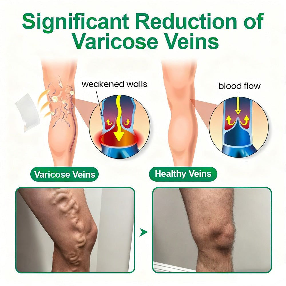 🗽👩‍⚕️👍Healrize® VeinTarget Microneedle Patch⚡Instant Relief, Long-Term Results