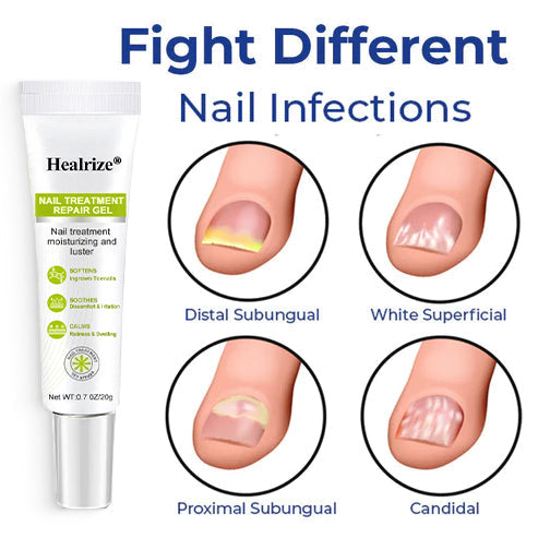 Healrize® NAIL TREATMENT REPAIR GEL(Removal Paronychia,Fungal infections, ingrown nail, discolored or damaged nails)💅