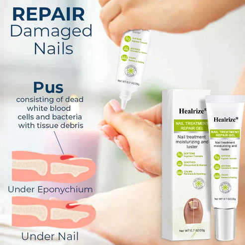Healrize® NAIL TREATMENT REPAIR GEL(Removal Paronychia,Fungal infections, ingrown nail, discolored or damaged nails)💅