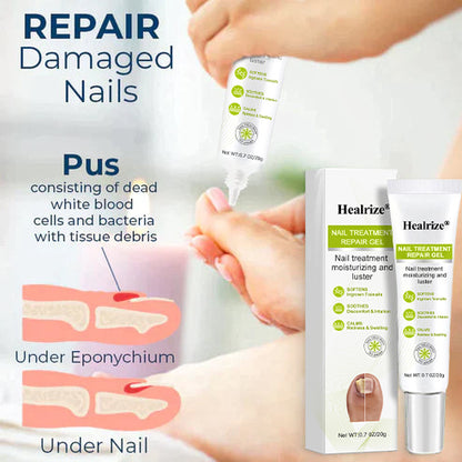 Healrize® NAIL TREATMENT REPAIR GEL(Removal Paronychia,Fungal infections, ingrown nail, discolored or damaged nails)💅