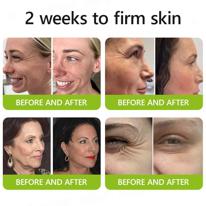 👩‍⚕️Made and shipped from USA 🏆Healrize® Botox & Vita-A Retinol Shot Wrinkle-Lift Tightening cream - Last Day Promotion 70% OFF🏆