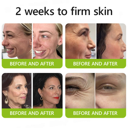 👩‍⚕️Made and shipped from USA 🏆Healrize® Botox & Vita-A Retinol Shot Wrinkle-Lift Tightening cream - Last Day Promotion 70% OFF🏆