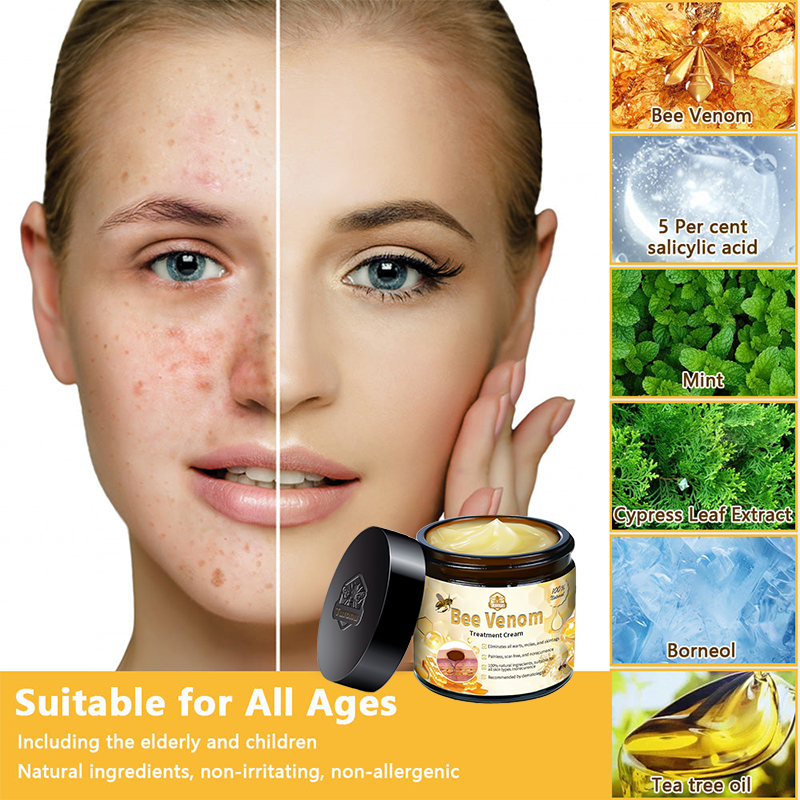 𝑇𝑢𝑟𝑜𝑛𝑢™ Bee Venom Skin Treatment Cream（𝐴𝐴𝐷 𝑅𝑒𝑐𝑜𝑚𝑚𝑒𝑛𝑑𝑒𝑑）🏵️