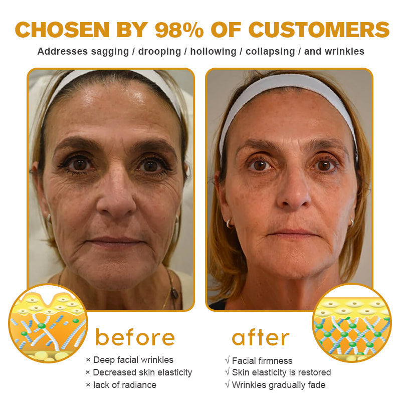 Made and shipped from the US🎁--Awzlove® Botox Bee Venom Wrinkle Removal Roll-On Cream-Last Day Promotion 70% OFF 🎁