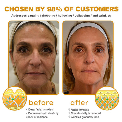 Made and shipped from the US🎁--Awzlove® Botox Bee Venom Wrinkle Removal Roll-On Cream-Last Day Promotion 70% OFF 🎁