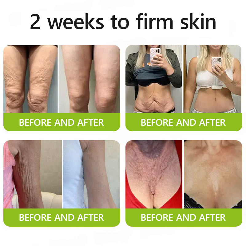 👩‍⚕️Made and shipped from USA 🏆Healrize® Botox & Vita-A Retinol Shot Wrinkle-Lift Tightening cream - Last Day Promotion 70% OFF🏆