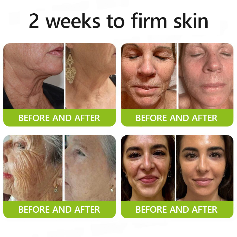 👩‍⚕️Made and shipped from USA 🏆Healrize® Botox & Vita-A Retinol Shot Wrinkle-Lift Tightening cream - Last Day Promotion 70% OFF🏆