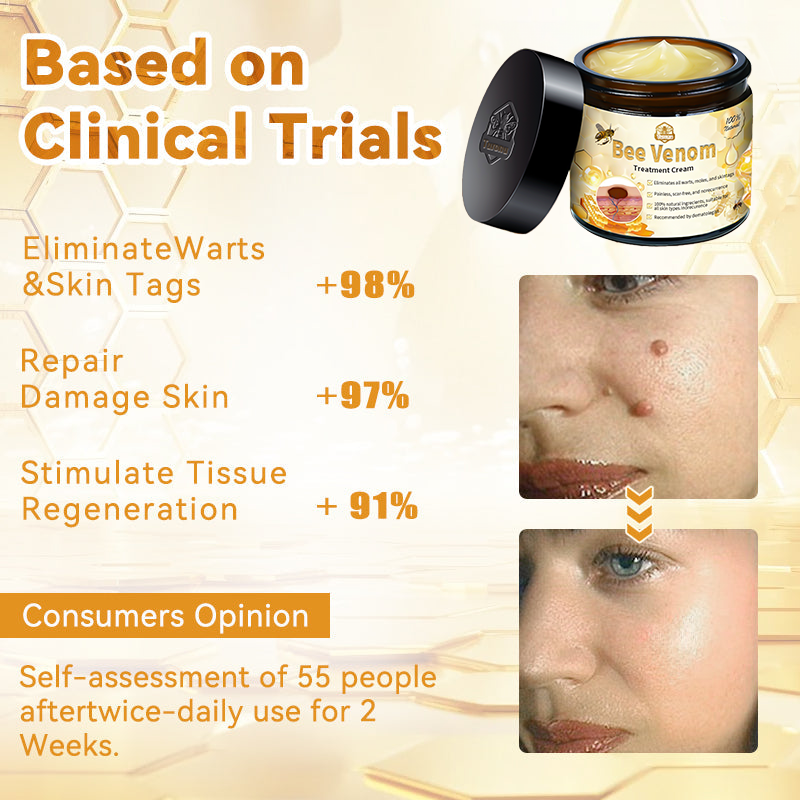 𝑇𝑢𝑟𝑜𝑛𝑢™ Bee Venom Skin Treatment Cream（𝐴𝐴𝐷 𝑅𝑒𝑐𝑜𝑚𝑚𝑒𝑛𝑑𝑒𝑑）🏵️
