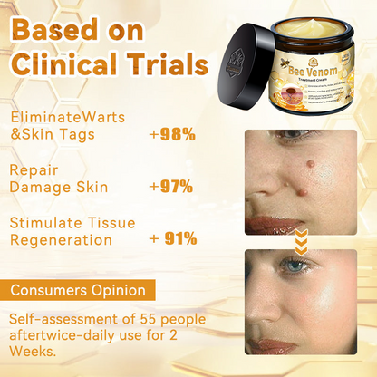 𝑇𝑢𝑟𝑜𝑛𝑢™ Bee Venom Skin Treatment Cream（𝐴𝐴𝐷 𝑅𝑒𝑐𝑜𝑚𝑚𝑒𝑛𝑑𝑒𝑑）🏵️