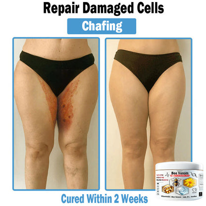 TODAHOF™ Bee Venom Multi-Symptom Skin Treatment Cream (NPF RECOMMENDS)💎