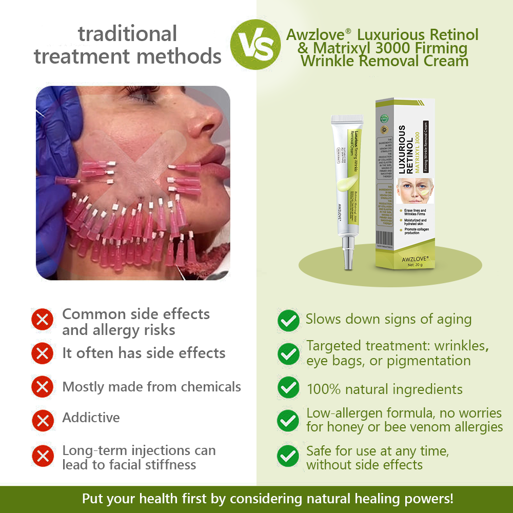 Made and shipped from the USA👩‍⚕️---Awzlove® Luxurious Retinol &  Matrixyl 3000 Firming Wrinkle Removal Cream💯-Last Day Promotion 70% OFF💯