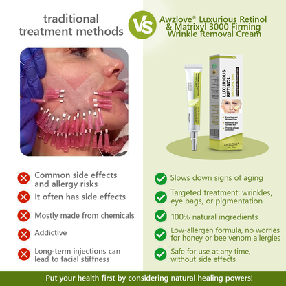 Made and shipped from the USA👩‍⚕️---Awzlove® Luxurious Retinol &  Matrixyl 3000 Firming Wrinkle Removal Cream💯-Last Day Promotion 70% OFF💯
